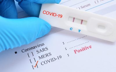 Delgado exige a la alcaldesa “que proteja a los trabajadores municipales” y costee la realización de test rápidos ante la inoperancia de la Junta